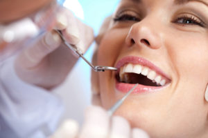 dental cleaning