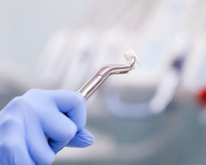 an extracted tooth held by a dentist